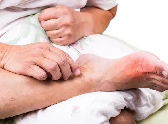 Лікарі встановили зв'язок між свининою в раціоні і подагрою