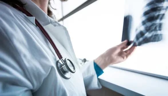 Туберкульоз: у серпні в Україні зареєстровано 1 622 випадки