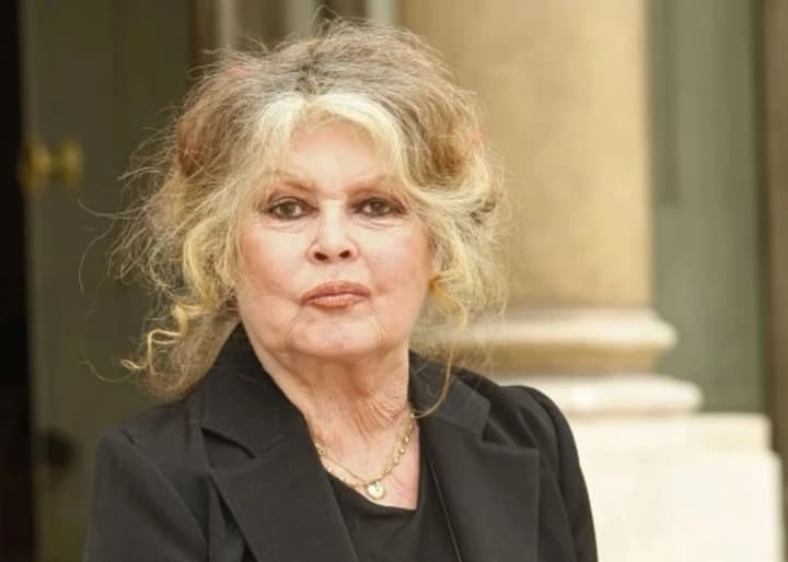 Iconic French actress Brigitte Bardot underwent surgery, doctors are monitoring her condition - Media