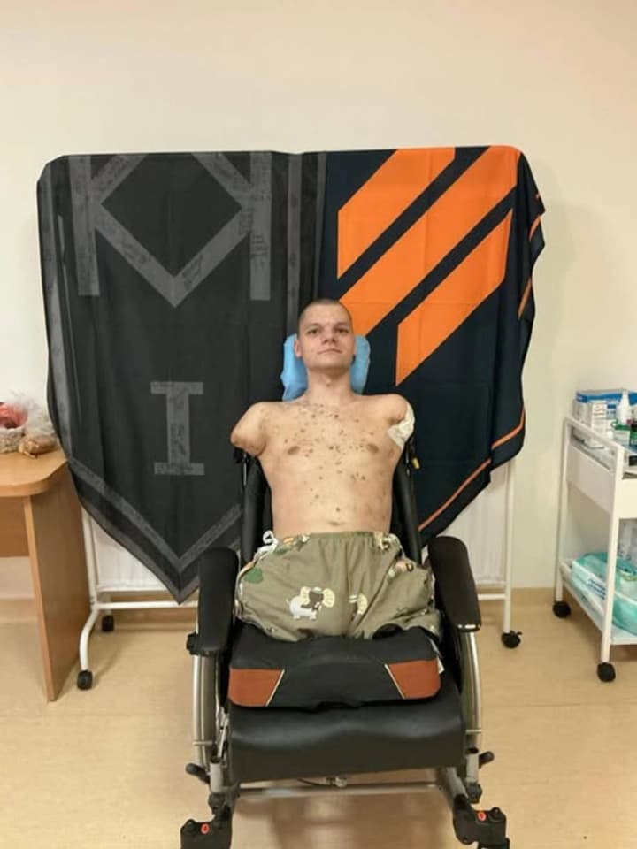 В отделении ПриватБанка ветерану с ампутацией отказали в восстановлении карты: в НБУ отреагировали