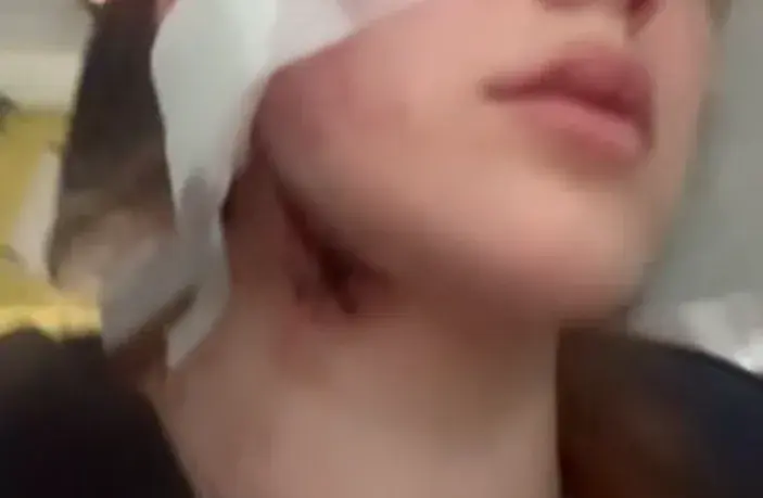 У мережі повідомили про напад на українських дівчину і хлопця у Вроцлаві через акцент