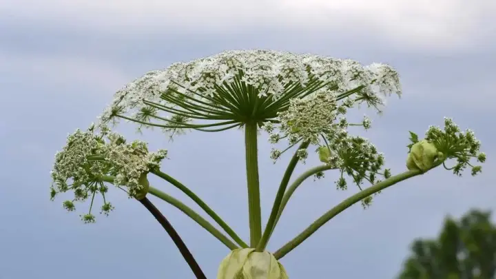 Why giant hogweed causes severe burns and what to do after contact — an allergist explained