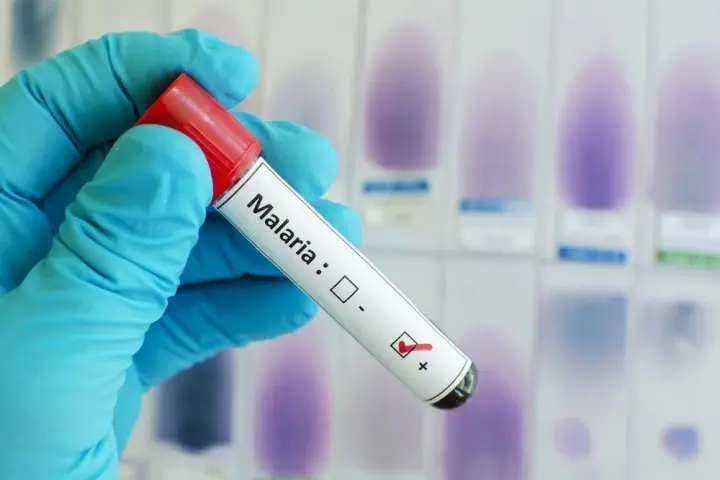Frankfurt reports a third malaria death; outbreak linked to the airport