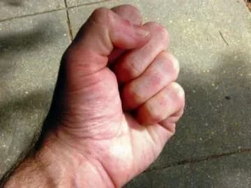 porizanogo-pensionera-znayshli-v-lisi-na-rivnenschini