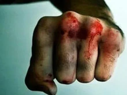 zhitel-donechchini-zabiv-spivmeshkanku-do-smerti