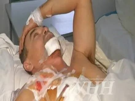 pokraschivsya-stan-rivnenskogo-vodiya-yakogo-na-khodu-avtomobilya-prostromila-metaleva-truba