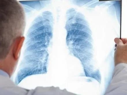 v-ukrayini-potribno-stvoryuvati-yedinu-sistemu-medichnogo-prostoru-profilaktiki-ta-rannogo-viyavlennya-zakhvoryuvan-v-knyazevich