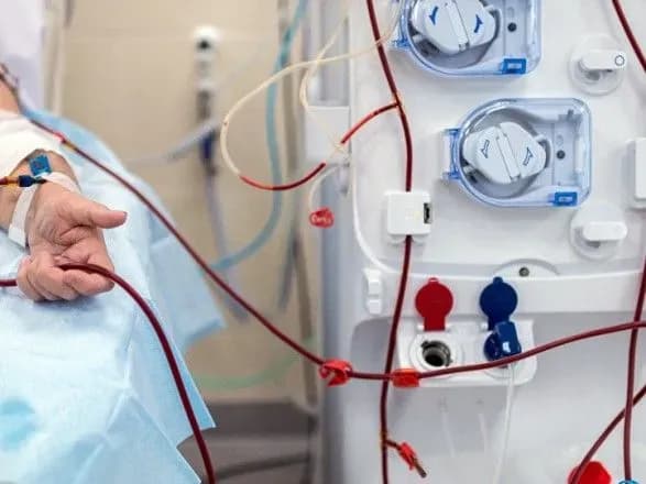 oborudki-iz-medmaterialami-dlya-gemodializu-grupa-kompaniy-privlasnila-ponad-60-mln-grn