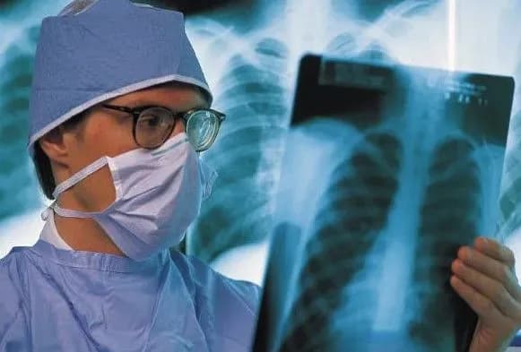 v-ukrayini-vprovadili-kompleksniy-pidkhid-do-protidiyi-tuberkulozu