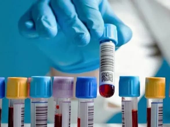 v-ukrayini-molodyatam-proponuvatimut-proyti-obstezhennya-na-torch-infektsiyi