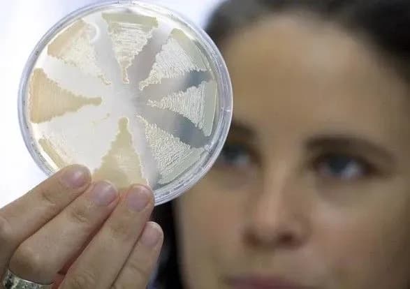 v-ukrayini-tsogo-roku-vzhe-58-vipadkiv-botulizmu-pyatero-lyudey-pomerli