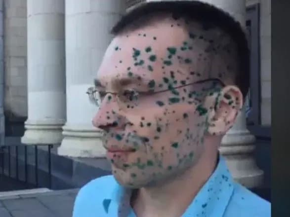 u-zhitomiri-zhurnalista-yakogo-zvinuvachuyut-u-derzhzradi-oblili-zelenkoyu