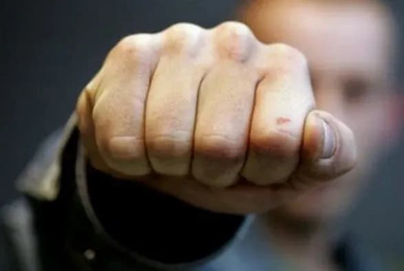 politsiya-galmuye-rozsliduvannya-napadu-na-biznesmena-scho-stavsya-sered-bilogo-dnya