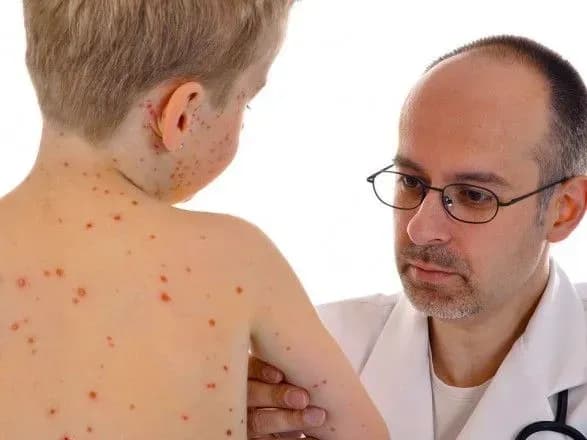 u-zaporizhzhi-chotiri-spivrobitniki-likarni-zakhvorili-na-kir