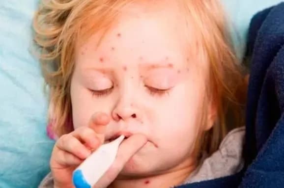 kir-na-odeschini-kilkist-khvorikh-dosyagla-vzhe-48