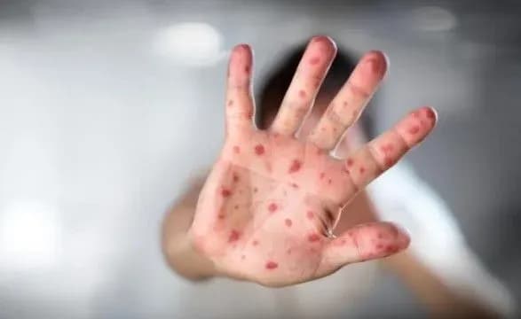 na-zavodi-v-zaporizhzhi-spalakh-koru