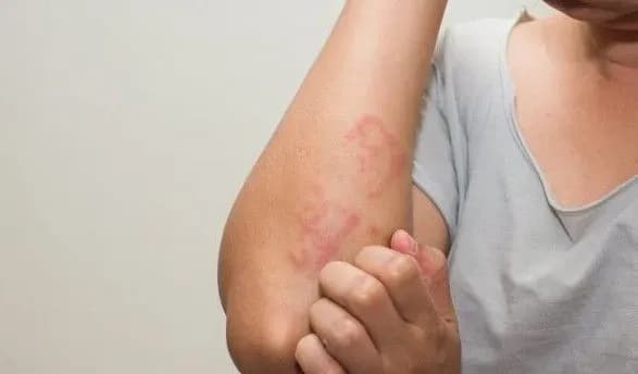 alergologi-oprilyudnili-prognoz-na-tizhden-dlya-ukrayintsiv-4