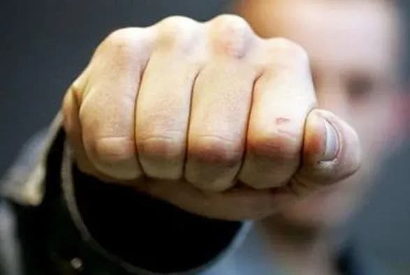 u-moskvi-pobili-likvidatora-avariyi-na-chaes