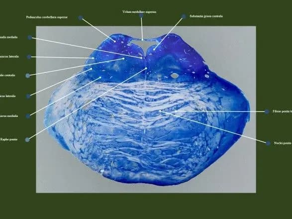 naukovtsi-viznachili-potentsiynu-skhilnist-do-alkogolizmu-za-siroyu-ridinoyu-u-mozku