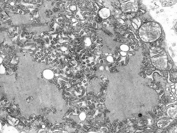 u-moldovi-vid-skazu-pomerla-ditina