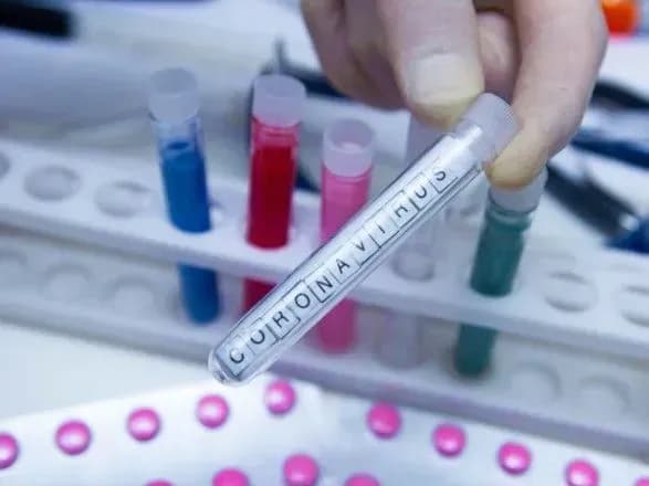 v-ukrayini-narazi-ne-zareyestrovano-zhodnogo-pidtverdzhenogo-vipadku-koronavirusu-moz