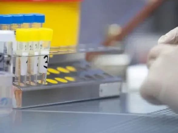 na-dnipropetrovschini-vzhe-25-pidozr-na-koronavirus-oda