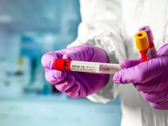 na-dnipropetrovschini-covid-19-laboratorno-pidtverdili-vzhe-u-8-osib