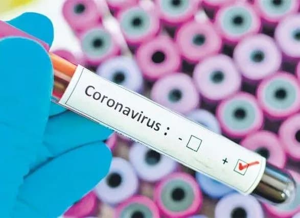 virus-nastupaye-za-dobu-u-kiyevi-zafiksovano-31-noviy-vipadok-covid-19-odna-lyudina-pomerla