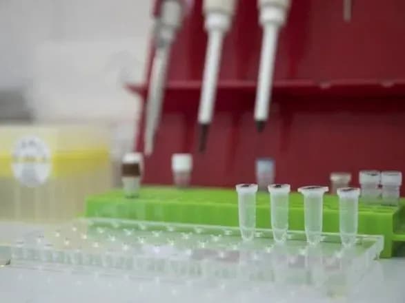 v-ukrayini-vzhe-145-tis-vipadkiv-covid-19-za-dobu-2-582