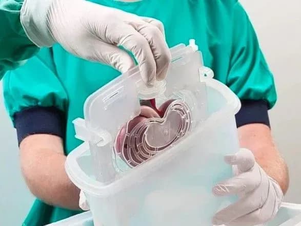 moz-planuye-pererozpodiliti-24-mln-grn-na-pilotniy-proekt-z-transplantatsiyi