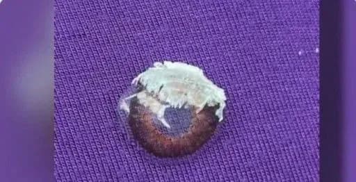 u-ssha-zhinka-vipadkovo-zakapala-sobi-ochi-kleyem