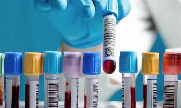 kabmin-dozvoliv-ukrayinskim-virobnikam-realizovuvati-preparati-na-osnovi-krovi-za-kordonom