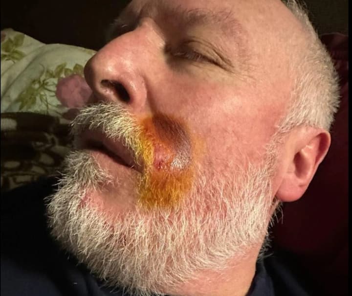 glovo-courier-hit-bloggers-father-with-brass-knuckles-police-investigate-incident