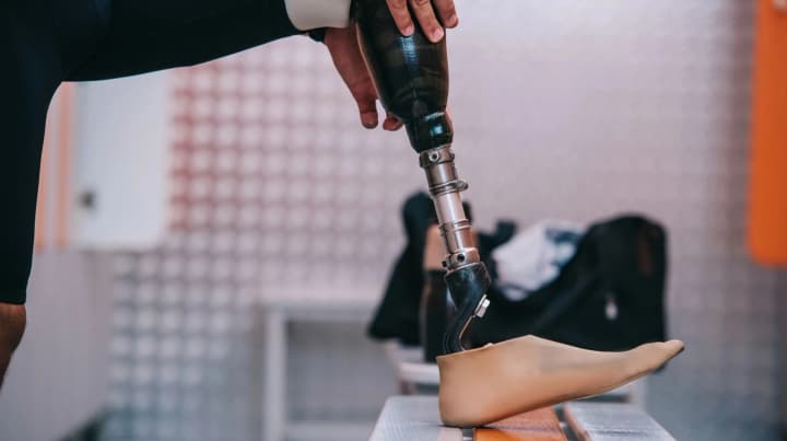 ukraine-to-increase-accessibility-of-prostheses-and-orthoses-for-victims-of-russian-aggression-what-will-change