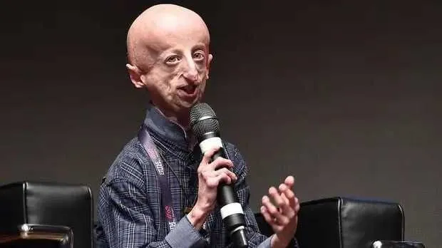 The oldest man with premature aging syndrome dies | УНН