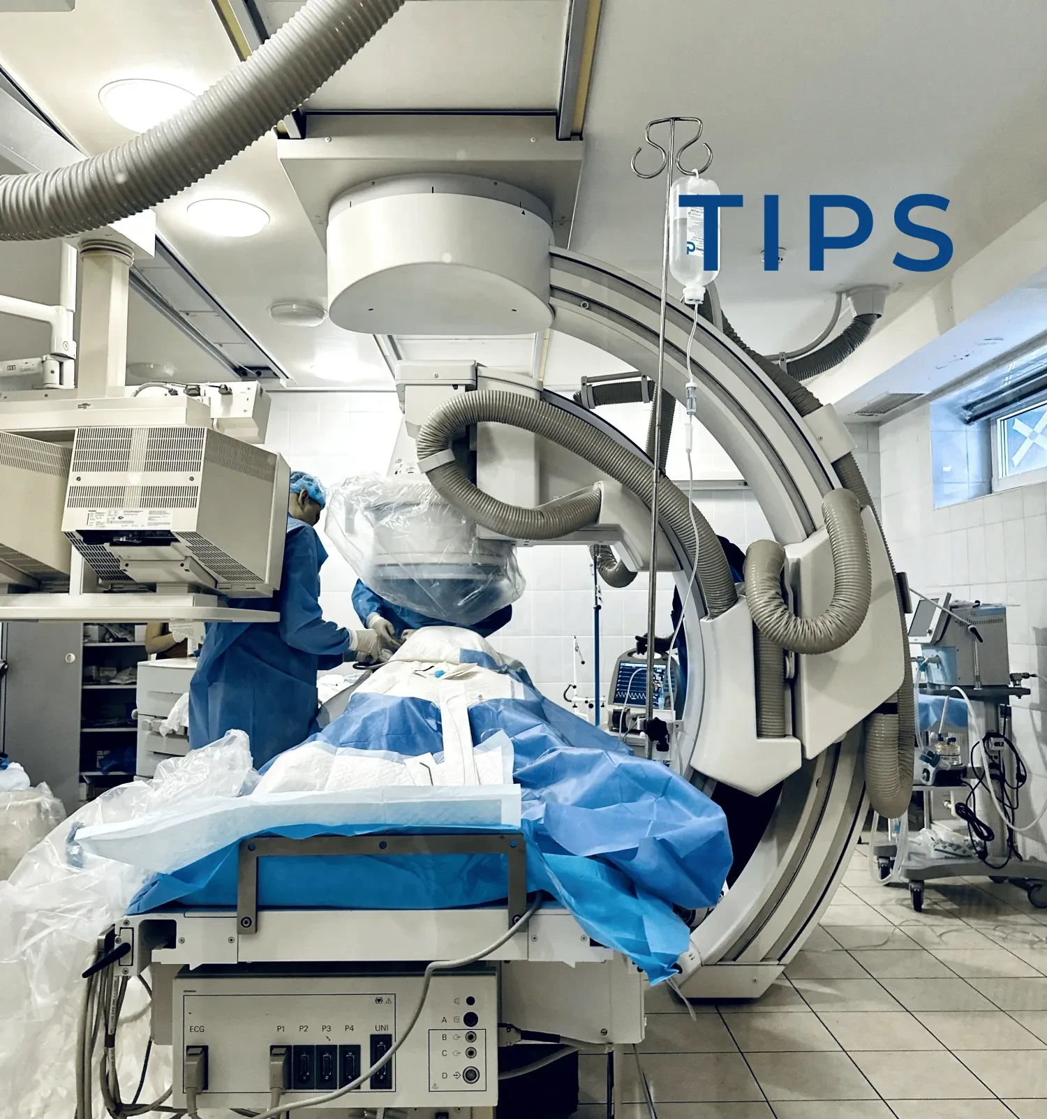 What is a TIPS operation and why is it performed - explained at the ...