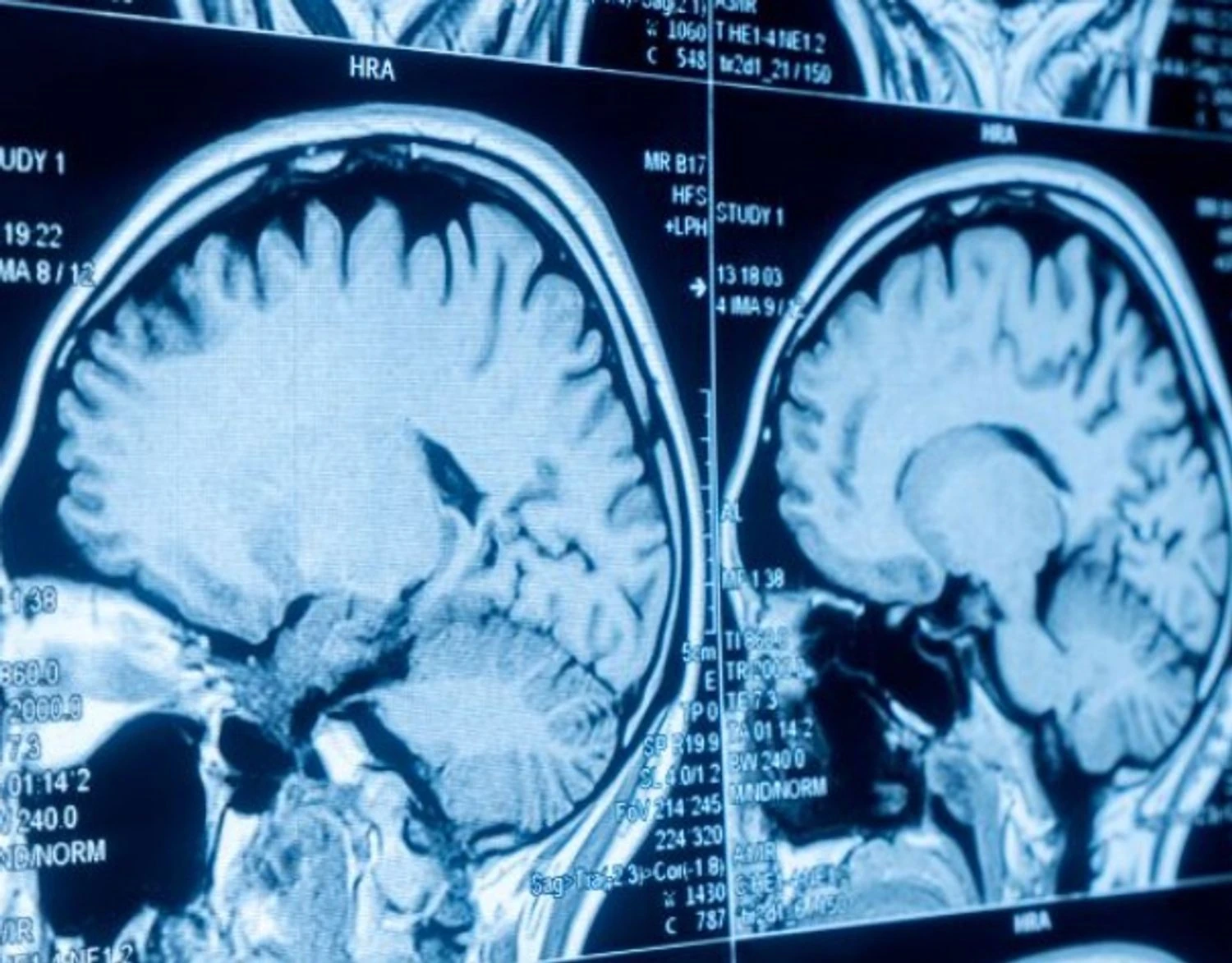 Підлітковий вік триває до 30 років: нове дослідження визначило п’ять фаз розвитку мозку