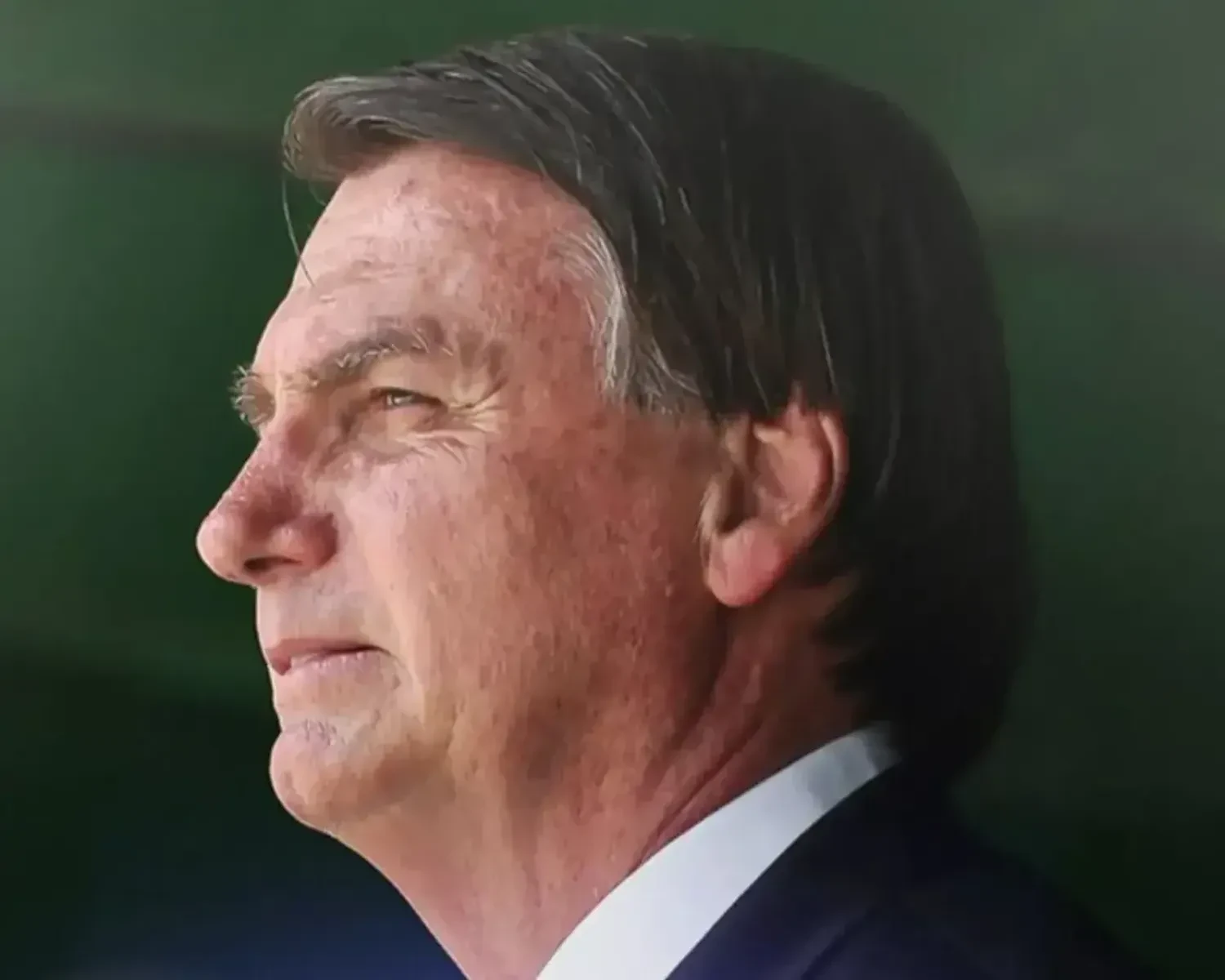 Brazil's ex-president Bolsonaro undergoes third surgery for hiccups