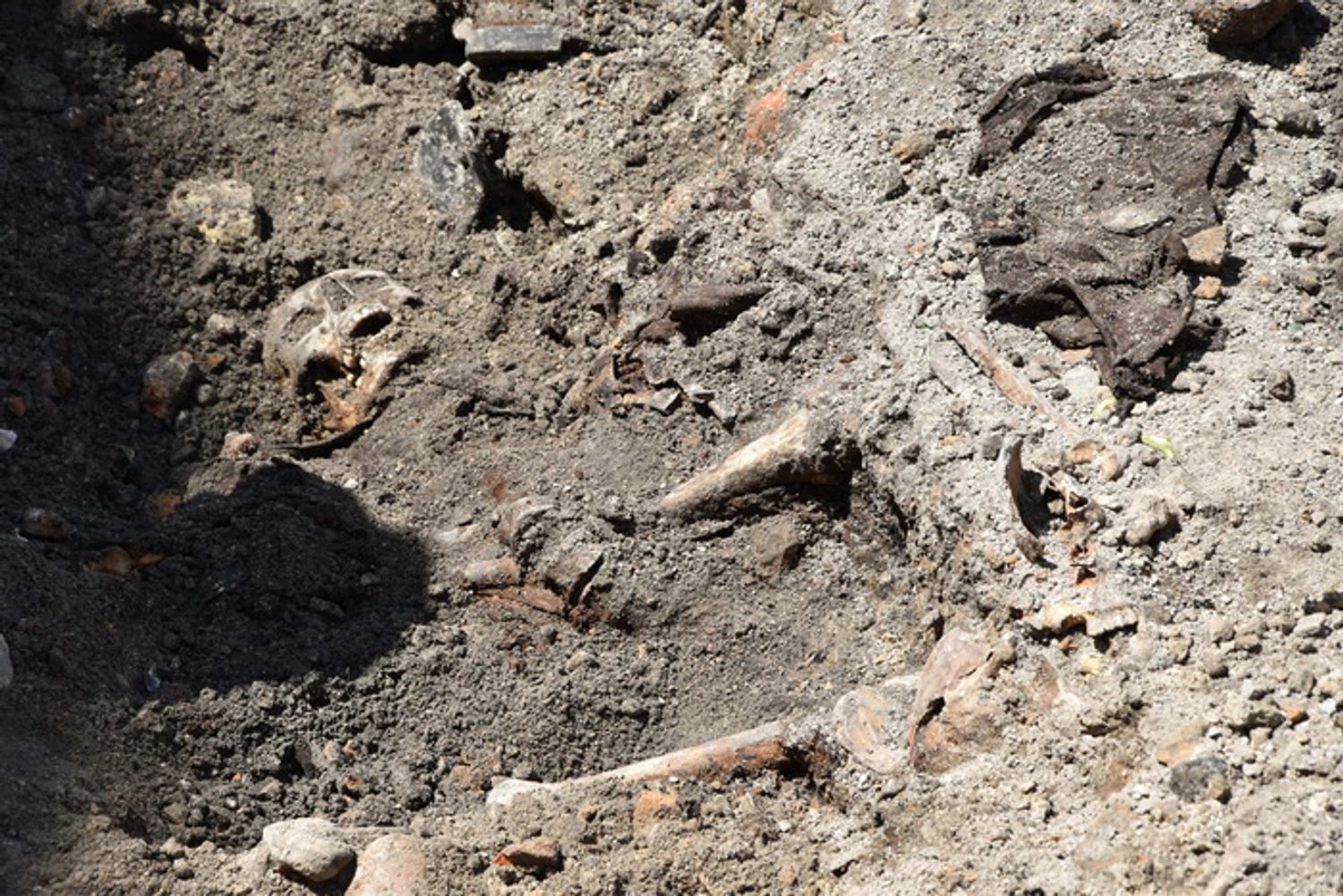 5,500-year-old human remains from Colombia indicate the spread of syphilis from America
