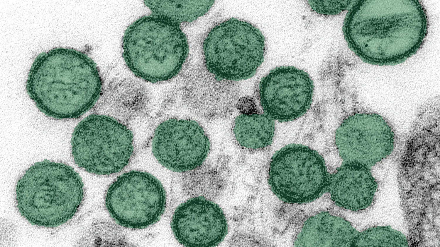 Argentina se apresura a encontrar fuente de infección por hantavirus