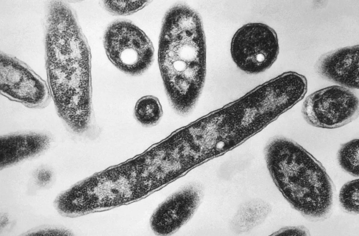 In New York, the number of victims of the Legionnaires' disease outbreak has increased